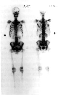 �ر�����֯��ȡ�������֤ʵΪ��ת��һ��