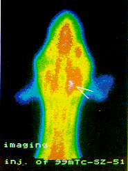 Ȯ���ڶ���Ѫ˨<sup>99m</sup>Tc-SZ-51���������о�