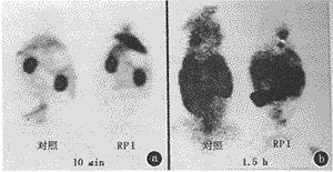 <sup>99</sup>Tc<sup>m</sup>-MIBI��Ϊ�ٹ�ע����ʾ�ټ��ĳ���ʵ���о�