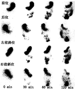 ��ͬ����λ�ⶨθ�ſյıȽ��о�