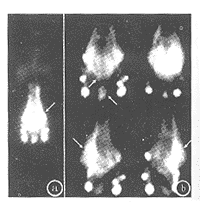 �ܰ�����λ�����ǻ��Ĥ���ܰ��쳣һ��