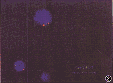 Ӧ��ӫ��ԭλ�ӽ������������̥��Ⱦɫ����Ŀ�쳣