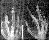 �ֲ��������ǲ�һ������