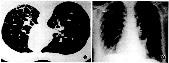 �ܰ͹ܼ�����һ��