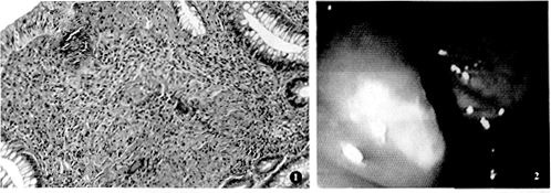 ���ڳ���˵Ĳ����仯