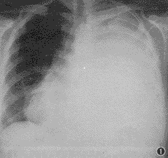 ��32���������ش�ƬƬ״��Ӱһ��