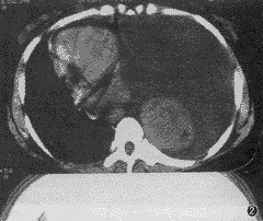 ��32���������ش�ƬƬ״��Ӱһ��