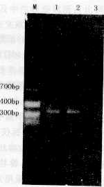 �ۺ�ø����Ӧ��⿨�Ϸ����ӳ�