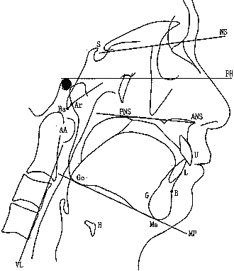 ������˯�ߺ�����ͣ���ߵ������Խṹ��������