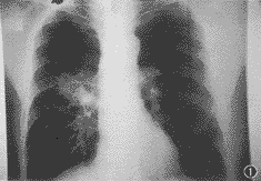 ��35�������ҷ��Ű�Ƭ״����Ӱ