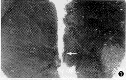 ��ǻ�����ۺ����Ľ���������