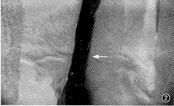 ��ǻ�����ۺ����Ľ���������