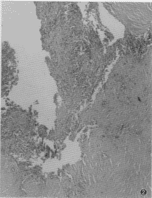 �����ر�Ѫ������������ά��֯ϸ����һ��