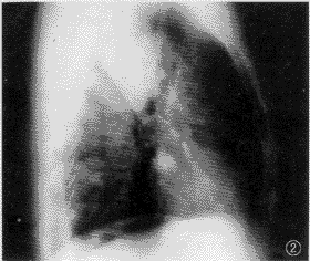 ��38��������δ�Ƭ�ں���Ӱ���ҷζ෢��Բ�ν��Ӱ