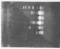 ������������Ѫ������ϸ����Th1/Th2��ϸ�����ӵ�ƫ��״̬����ù�صľ�ƫ����