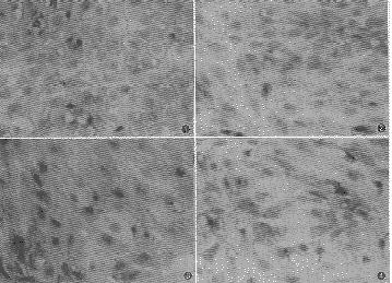 ����������ȡ����Ұ������ἤø���Ƽ�����������Ƥϸ���������ر����Ӱ��