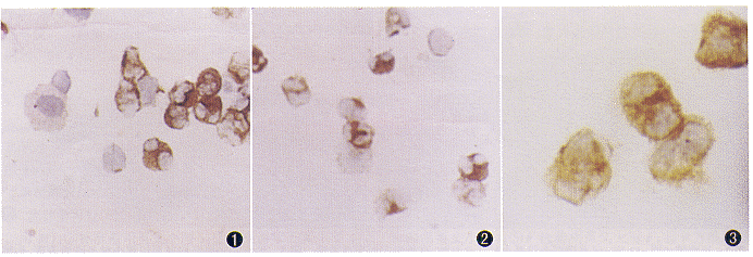 ���������Էμ���������Ƥ�ʼ�������ǰ��̵Һ������ϸ��CD11b����仯