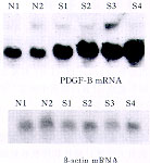 Sneddon�ۺ���һ������??