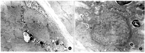 ���������弡�׵��ٴ��벡���ص�