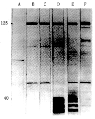 ��-Amphiphysin��������ϵͳ�������ۺ���������ѧ�о�