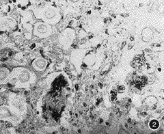 �������������Ĥ���������ٴ���������