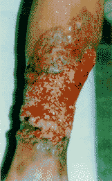 ��37�����������Գ鴤��˫��֫����