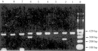 �����ϸ����ԭDRB1������෢��Ӳ���Ŵ��׻����о�