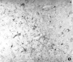 �쳣PrP���������õ��ײ����ٴ��Ͳ���Ӱ��