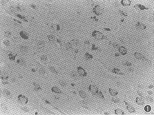 �����������ȱѪ������֯