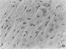 �����������ȱѪ������֯