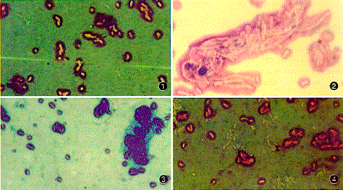 ϸ��������Ⱦɫ��΢����⼼��