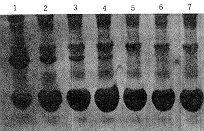 ��֢����Ѫ��ͭ��ϵ��׵ļ��