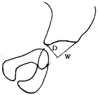 �������Źؽ���λ�պϸ�λ�ڼ�X�߲����ı仯�۲�