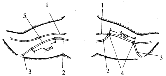 ͨ���˲��Ͽ˷���Χ��ȱ���ʵ���о�