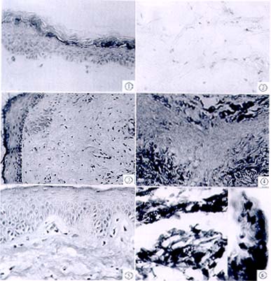 ����Ƥ��ֲ��ƤƬ��������������ļ��