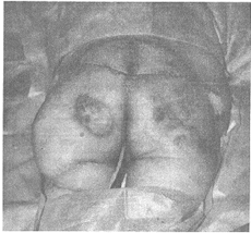 ��Ƥ���޸��෢�촯һ��