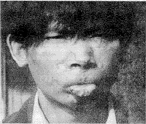 ǰ�۳߲����������뼡Ƥ���´�����