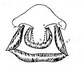 ǰ����ǰͻ��˫�ഽ���޸���