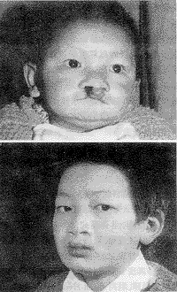 ǰ����ǰͻ��˫�ഽ���޸���