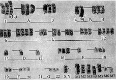 ���и�ת��Ǳ�ܵ��˸ΰ�ϸ��ϵ�Ľ�����������ѧ����