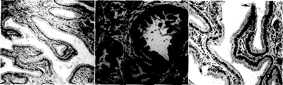 P-�ǵ����ڵ��������������еı���