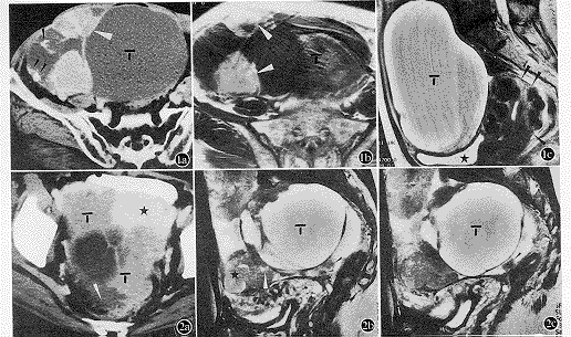 CT�ʹŹ��������ԭ�����ѳ��������е�Ӧ��