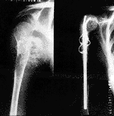 �Źǽ��������г����ؽڹ��ܵ��ؽ�