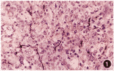 �Ǿ�ϸ������΢Ѫ���ܶ��������ּ��͸�����ϵ�ĳ�������