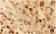 �Ǿ�ϸ������΢Ѫ���ܶ��������ּ��͸�����ϵ�ĳ�������