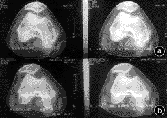 �ƹɹؽ������쳣��CT���