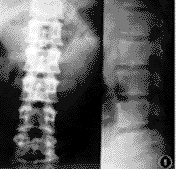 ��׵�������������ں�����Ӧ��