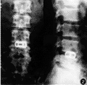 ��׵�������������ں�����Ӧ��