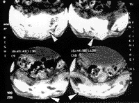 ���ǹ��ۺ�������խ�����´�һ������