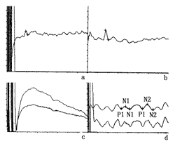 ����շ���λ�͸о��񾭵�λ�ڲ�̱�����е�����